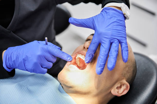 Best Tooth Infection Emergency Dentist  in Holiday Valley, OH
